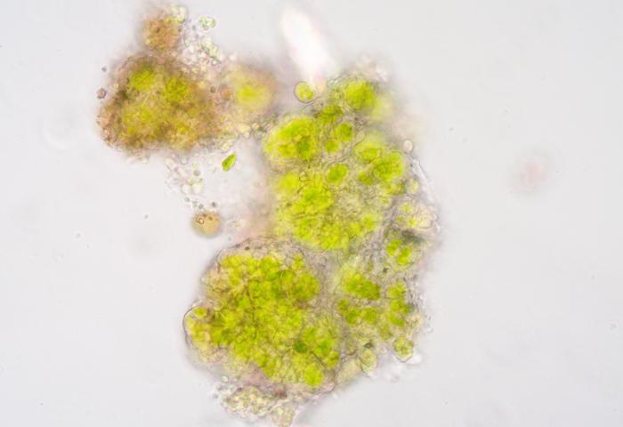 <p>Fig. 6.06 Analysis of collected sample with microscope - algae ©Katja Sterflinger</p>